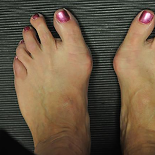 De bedste vandrest&oslash;vler til knyster